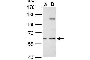 WB Image GALNS antibody detects GALNS protein by Western blot analysis.