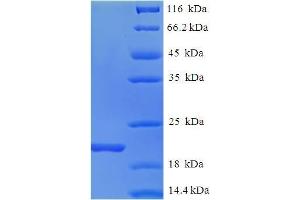 SDS-PAGE (SDS) image for Ionized Calcium-binding Adapter Molecule 1 (IBA1) (AA 2-147) protein (His tag) (ABIN5709021)
