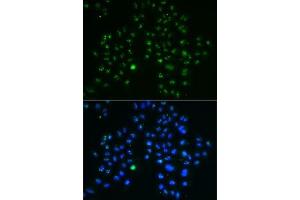 Immunofluorescence analysis of MCF7 cells using GNL3 antibody (ABIN6130343, ABIN6141249, ABIN6141250 and ABIN6222113).