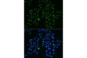 Immunofluorescence analysis of MCF7 cells using GNL3 antibody (ABIN6130343, ABIN6141249, ABIN6141250 and ABIN6222113). (Nucleostemin anticorps  (AA 1-240))
