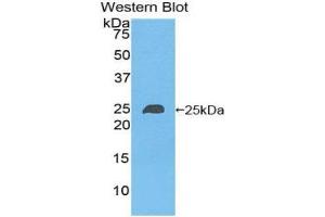 Western Blotting (WB) image for anti-NME/NM23 Nucleoside Diphosphate Kinase 6 (NME6) (AA 3-182) antibody (ABIN1860011)