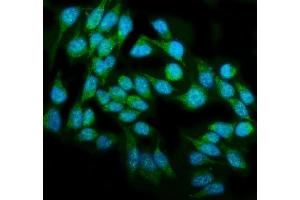 IF analysis of DAI/ZBP1 using anti-DAI/ZBP1 antibody (ABIN7600499).