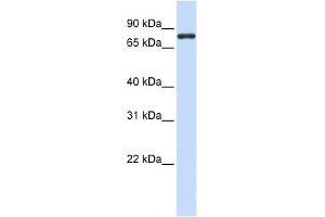 ACP6 antibody used at 1 ug/ml to detect target protein. (ACP6 anticorps  (N-Term))