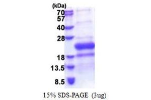 SDS-PAGE (SDS) image for Tumor Necrosis Factor Receptor Superfamily, Member 14 (TNFRSF14) (AA 39-202) protein (His tag) (ABIN5853390)