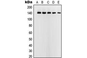 Western blot analysis of USF2 expression in HeLa (A), Jurkat (B), K562 (C), A431 (D), NIH3T3 (E) whole cell lysates.
