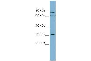 WB Suggested Anti-CUTC  Antibody Titration: 0. (CUTC anticorps  (Middle Region))