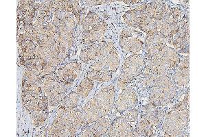 IHC analysis of COPE using anti-COPE antibody (ABIN7602509). (COPE anticorps  (AA 80-308))