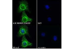 ABIN570699 Immunofluorescence analysis of paraformaldehyde fixed A549 cells, permeabilized with 0. (HMGCR anticorps  (Internal Region))