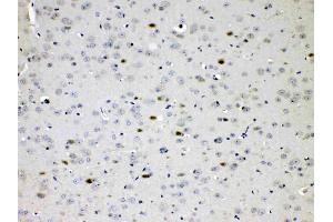 IHC analysis of CHAT using anti- CHAT antibody .