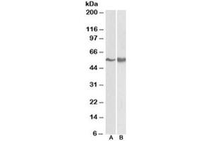 Western blot testing of A431 [A] and Jurkat lysate [B] with FYN antibody at 0. (FYN anticorps)