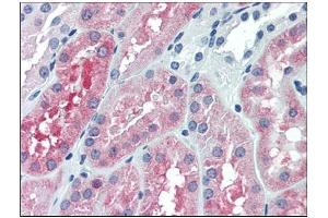 Immunohistochemistry (IHC) image for anti-Oculocerebrorenal Syndrome of Lowe (OCRL) (AA 146-240) antibody (ABIN782420)