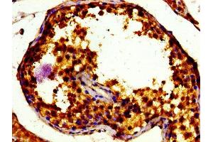 anti-Transcription Factor E3 (TFE3) (AA 1-110) antibody