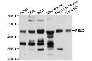Western blot analysis of extracts of various cells, using PELO antibody. (PELO anticorps)