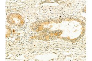 ABIN6265394 and ABIN6266638 at 1/100 staining Human normal tissues adjacent to pancreatic cancer by IHC-P. (Synaptophysin anticorps  (Internal Region))