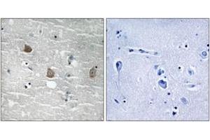 Immunohistochemistry analysis of paraffin-embedded human brain, using TOB1 (Phospho-Ser164) Antibody. (Protein Tob1 (TOB1) (AA 130-179), (pSer164) anticorps)