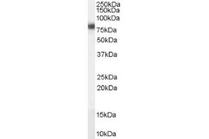 Image no. 1 for anti-Carnitine Palmitoyltransferase 1A (Liver) (CPT1A) (Internal Region) antibody (ABIN374737) (CPT1A anticorps  (Internal Region))