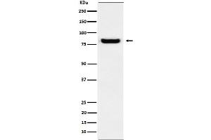 Western blot analysis of GLU2B expression in A431 cell lysate.
