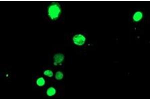 Image no. 3 for anti-T-Cell Acute Lymphocytic Leukemia 1 (TAL1) antibody (ABIN1501295) (TAL1 anticorps)