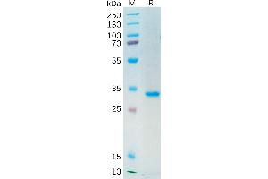 Human AXL Protein, mFc Tag on SDS-PAGE under reducing condition.