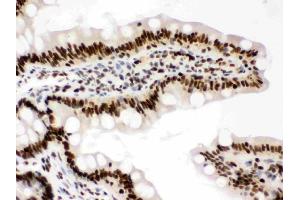 IHC analysis of RbAp48 using anti-RbAp48 antibody (ABIN3043920). (Retinoblastoma Binding Protein 4 anticorps  (C-Term))