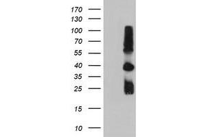 Western Blotting (WB) image for anti-Metalloproteinase Inhibitor 2 (TIMP2) antibody (ABIN1501393) (TIMP2 anticorps)