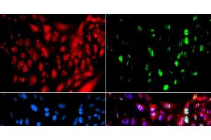 Immunofluorescence analysis of GFP-RNF168 transgenic U2OS cells using UIMC1 Polyclonal Antibody (UIMC1 anticorps)