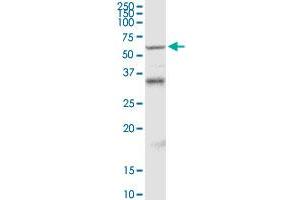 MDM4 MaxPab rabbit polyclonal antibody.