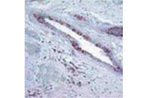 Image no. 2 for anti-Retinoblastoma Protein (Rb Protein) (Cleavage Site) antibody (ABIN207915) (Retinoblastoma Protein (Rb) anticorps  (Cleavage Site))