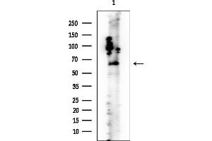 Western blot analysis of lysates from Rat lung, using Alanine Transaminase Mouse Monoclonal Antibody at 1/1000 dilution.