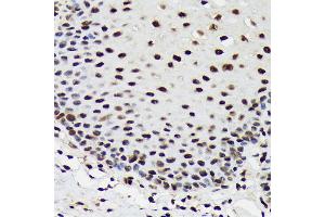 Immunohistochemistry of paraffin-embedded human esophageal using SF3B3/S Rabbit mAb (ABIN7270544) at dilution of 1:100 (40x lens). (SF3B3 anticorps)