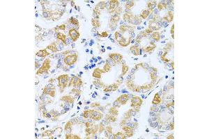 Immunohistochemistry of paraffin-embedded human stomach using IRS1 antibody (ABIN5970075) at dilution of 1/100 (40x lens). (IRS1 anticorps)