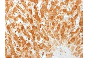 Formalin-fixed, paraffin-embedded human Liver stained with Connexin 32 Monoclonal Antibody (GJB1/1753) (GJB1 anticorps)