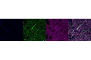 Immunohistochemistry (IHC) image for anti-Microtubule-Associated Protein 2 (MAP2) antibody (ABIN7455981) (MAP2 anticorps)