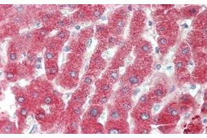 Detection of C4B in Human Liver Tissue using Polyclonal Antibody to Complement C4-B (C4B)