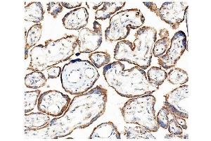 IHC analysis of Hexokinase 1/HK1 using anti-Hexokinase 1/HK1 antibody (ABIN7600258). (Hexokinase 1 anticorps  (AA 17-323))
