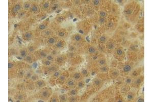 anti-P-Cadherin (CDH3) (AA 371-660) antibody