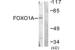 Western blot analysis of extracts from HeLa cells, treated with Serum 20% 15', using FOXO1A (Ab-329) Antibody. (FOXO1 anticorps  (AA 295-344))