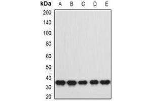 Western blot analysis of hnRNP A0 expression in MCF7 (A), SKOV3 (B), Hela (C), mouse spleen (D), mouse brain (E) whole cell lysates. (HNRNPA0 anticorps)