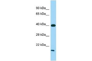 Host: Rabbit Target Name: GPR21 Sample Type: Fetal Heart lysates Antibody Dilution: 1. (GPR21 anticorps  (C-Term))