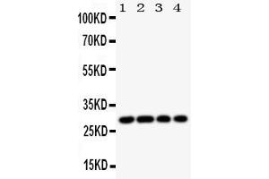 Anti-HLA DMB antibody, Western blottingAll lanes: Anti HLA DMB  at 0.