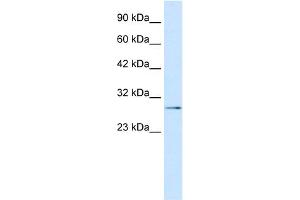 WB Suggested Anti-TBX20 Antibody Titration: 0. (TBX20 anticorps  (N-Term))
