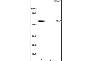 Lane 1: mouse liver lysates Lane 2: rat brain lysates probed with Anti OAT-1/SLC22A6 Polyclonal Antibody, Unconjugated (ABIN670791) at 1:200 overnight at 4 °C. (Slco1a1 anticorps  (AA 2-90))