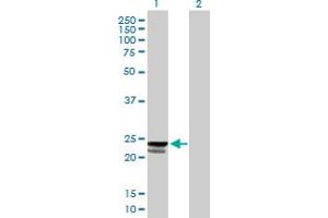 Western Blot analysis of C9orf115 expression in transfected 293T cell line by C9orf115 MaxPab polyclonal antibody. (PTRH1 anticorps  (AA 1-214))