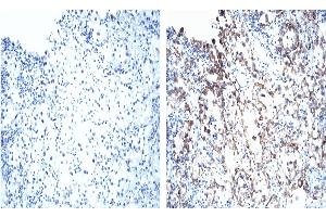 Immunohistochemistry (IHC) image for anti-Von Hippel-Lindau Tumor Suppressor, E3 Ubiquitin Protein Ligase (VHL) (AA 1-213) antibody (ABIN967508)