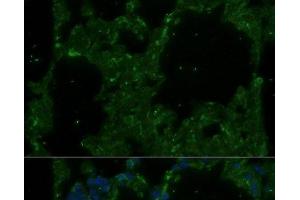 Immunofluorescence analysis of Rat lung using TREM2 Polyclonal Antibody at dilution of 1:100. (TREM2 anticorps)