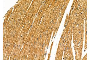 ABIN6259842 and ABIN6277280 at 1/100 staining Rat heart tissue by IHC-P. (AIF anticorps  (C-Term))