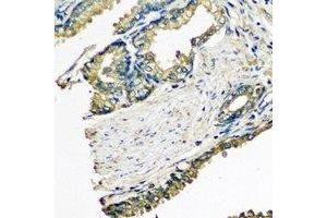 Immunohistochemical analysis of ETFA staining in human prostate formalin fixed paraffin embedded tissue section. (ETFA anticorps)