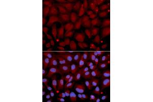 Immunofluorescence analysis of U2OS cells using BCHE antibody (ABIN5970682). (Butyrylcholinesterase anticorps)