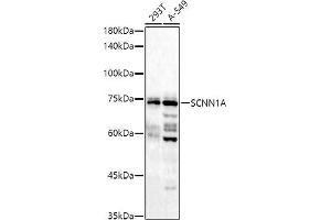 Western blot analysis of extracts of various cell lines, using (ABIN6129465, ABIN6147447, ABIN6147448 and ABIN6221186) at 1:1000 dilution. (SCNN1A anticorps  (AA 105-225))