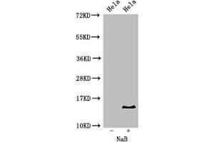 Western Blot Positive WB detected in: Hela cell acid extracts treated by NaB All lanes: HIST1H2BB antibody at 2 μg/mL Secondary Goat polyclonal to rabbit IgG at 1/50000 dilution Predicted band size: 14 kDa Observed band size: 14 kDa (HIST1H2BB anticorps  (acLys16))
